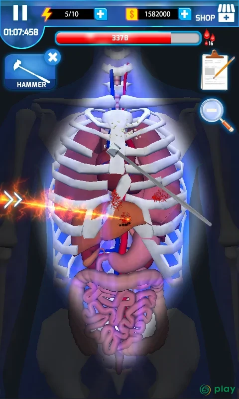 Мастер хирург - Surgery Master — скриншот 2